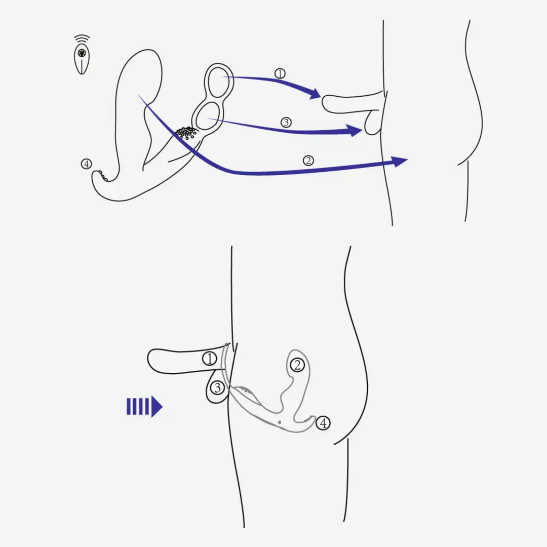 product depiction of how to use Prostate Curve Dual Ring - Remote Control Vibrating Prostate Massager diagram 