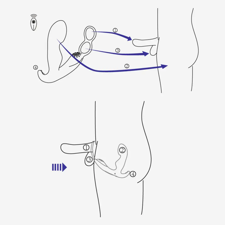product depiction of how to use Prostate Curve Dual Ring - Remote Control Vibrating Prostate Massager diagram 